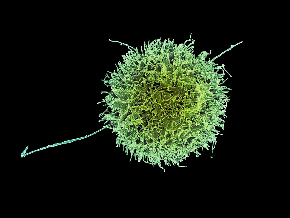 Colorized scanning electron micrograph of a natural killer cell from a human donor. Credit: NIAID