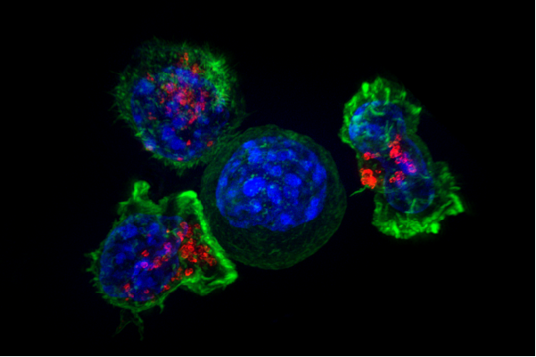 Image of a group of killer T cells (green and red) surrounding a cancer cell (blue, center). When a killer T cell makes contact with a target cell, the killer cell attaches and spreads over the dangerous target. The killer cell then uses special chemicals housed in vesicles (red) to deliver the killing blow. This event has thus been nicknamed “the kiss of death”. After the target cell is killed, the killer T cells move on to find the next victim.