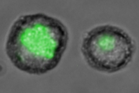 Silica Nanoparticles with fluorescent epitope (green) taken up by MUTZ-3 cells